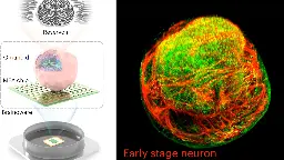 A 'brain organoid' biochip displayed serious voice recognition and math skills